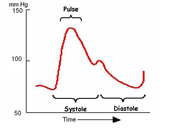 Pulse with diastole and systole.JPG