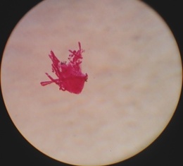 File:Bipinnaria larva.jpg