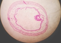 Earthworm typhlosolar region.jpg