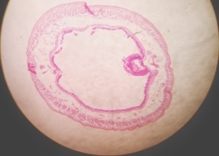 File:Earthworm typhlosolar region.jpg
