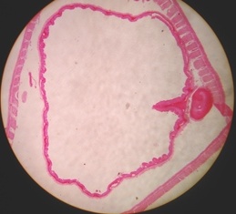 File:Earthworm typhlosole region.jpg