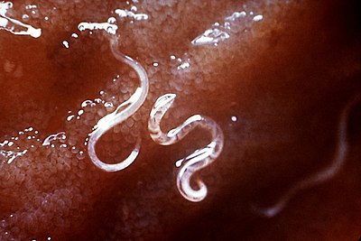 nemathelminthes hookworm