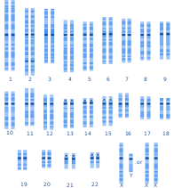 A typical human (male) karyotype